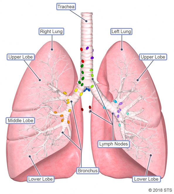 mesothelioma is a malignant tumors that is caused by