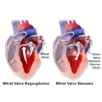 Home - Newport Cardiac & Thoracic Surgery